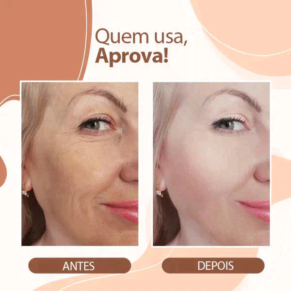 Derol Silky® – Hidratante Minimizador de rugas, olheiras e manchas.